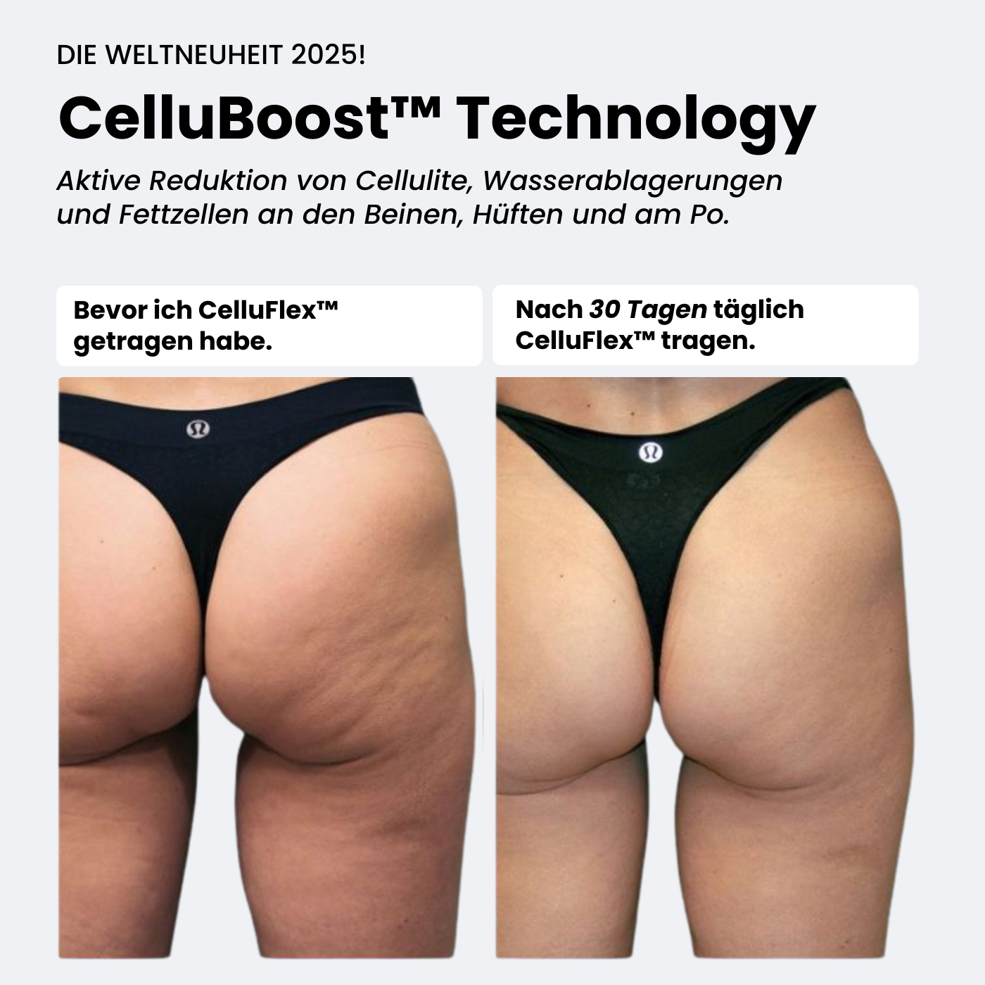 COREEX CelluFlex™ - #1 Anti-Cellulite Leggings