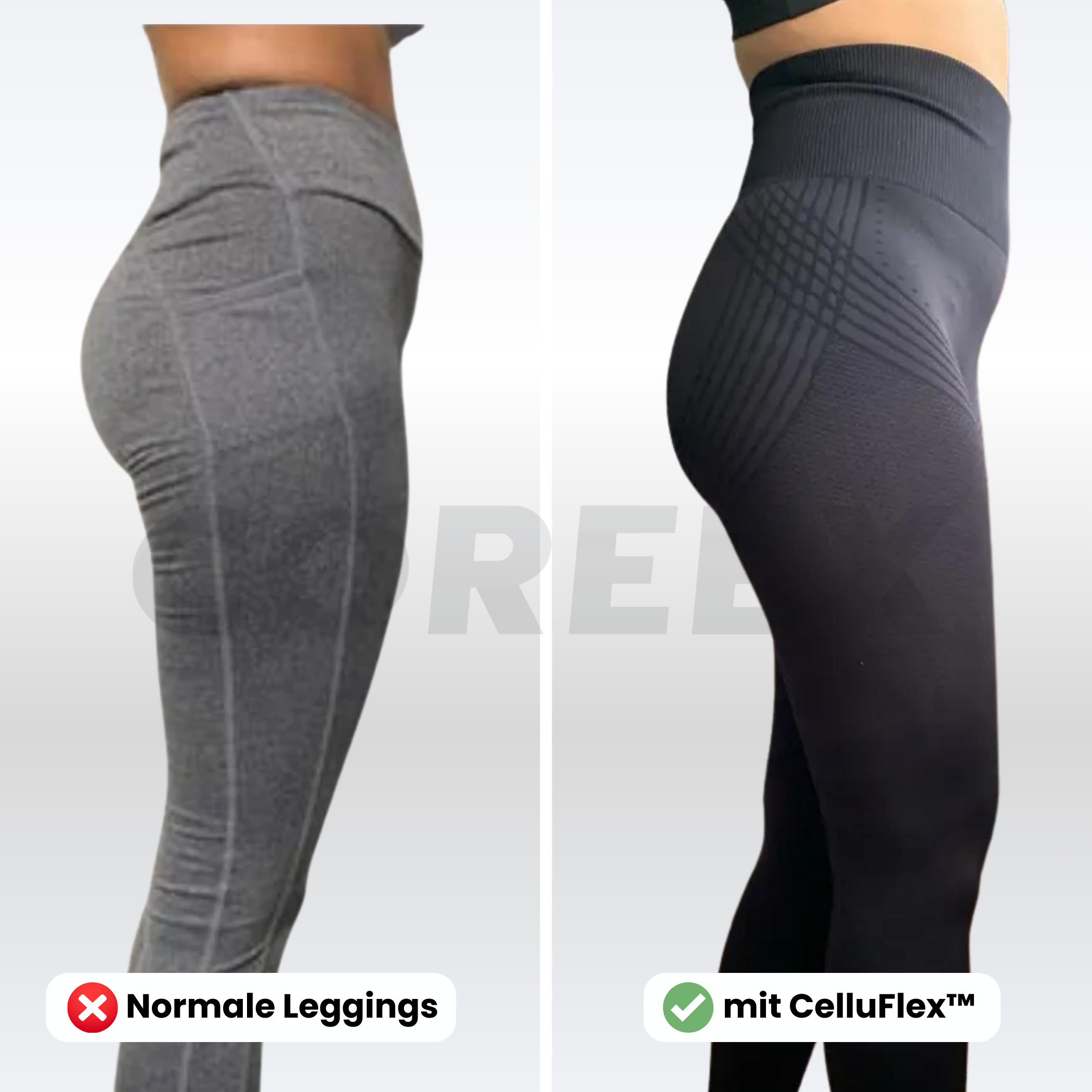 COREEX CelluFlex™ - #1 Anti-Cellulite Leggings der Schweiz
