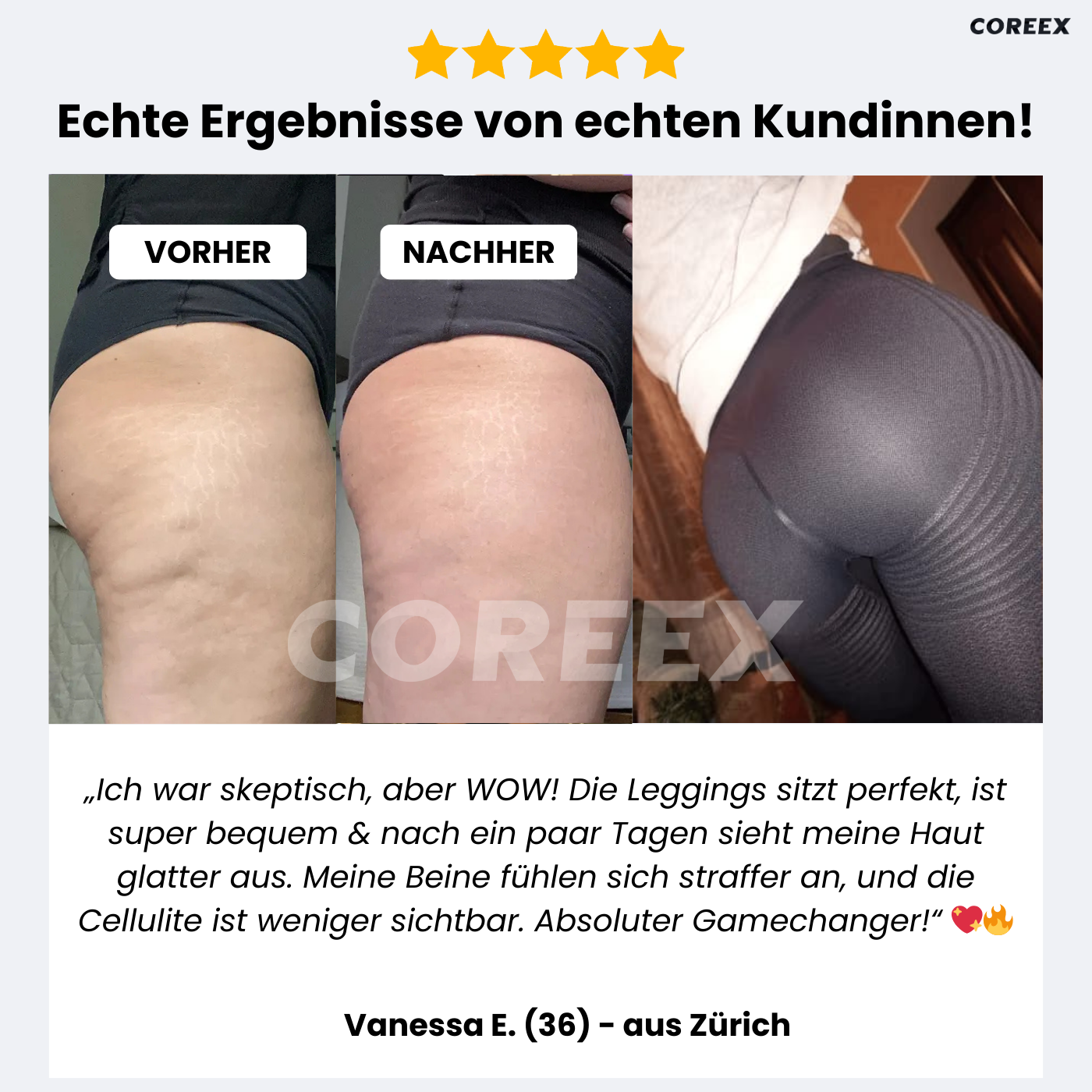 COREEX CelluFlex™ - #1 Anti-Cellulite Leggings der Schweiz