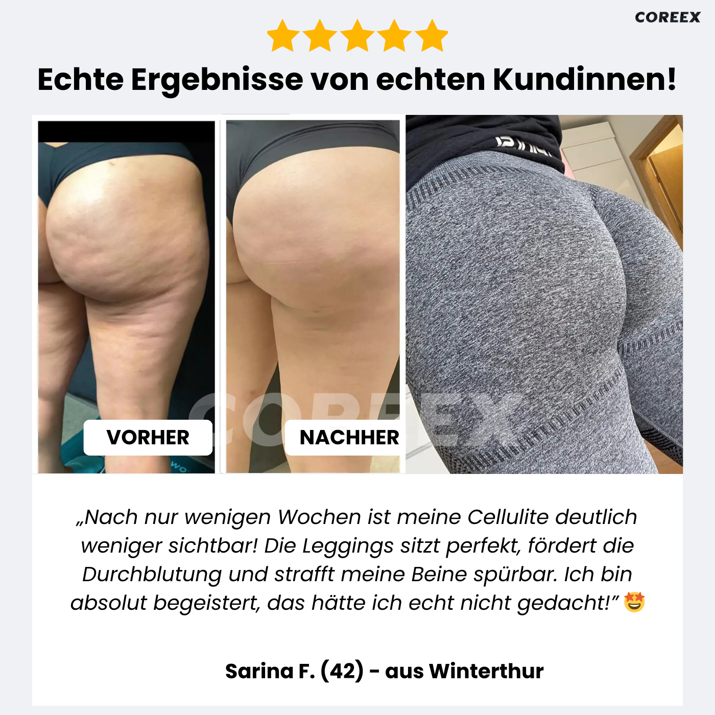 COREEX CelluFlex™ - #1 Anti-Cellulite Leggings der Schweiz